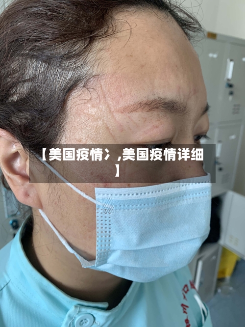 【美国疫情冫,美国疫情详细】